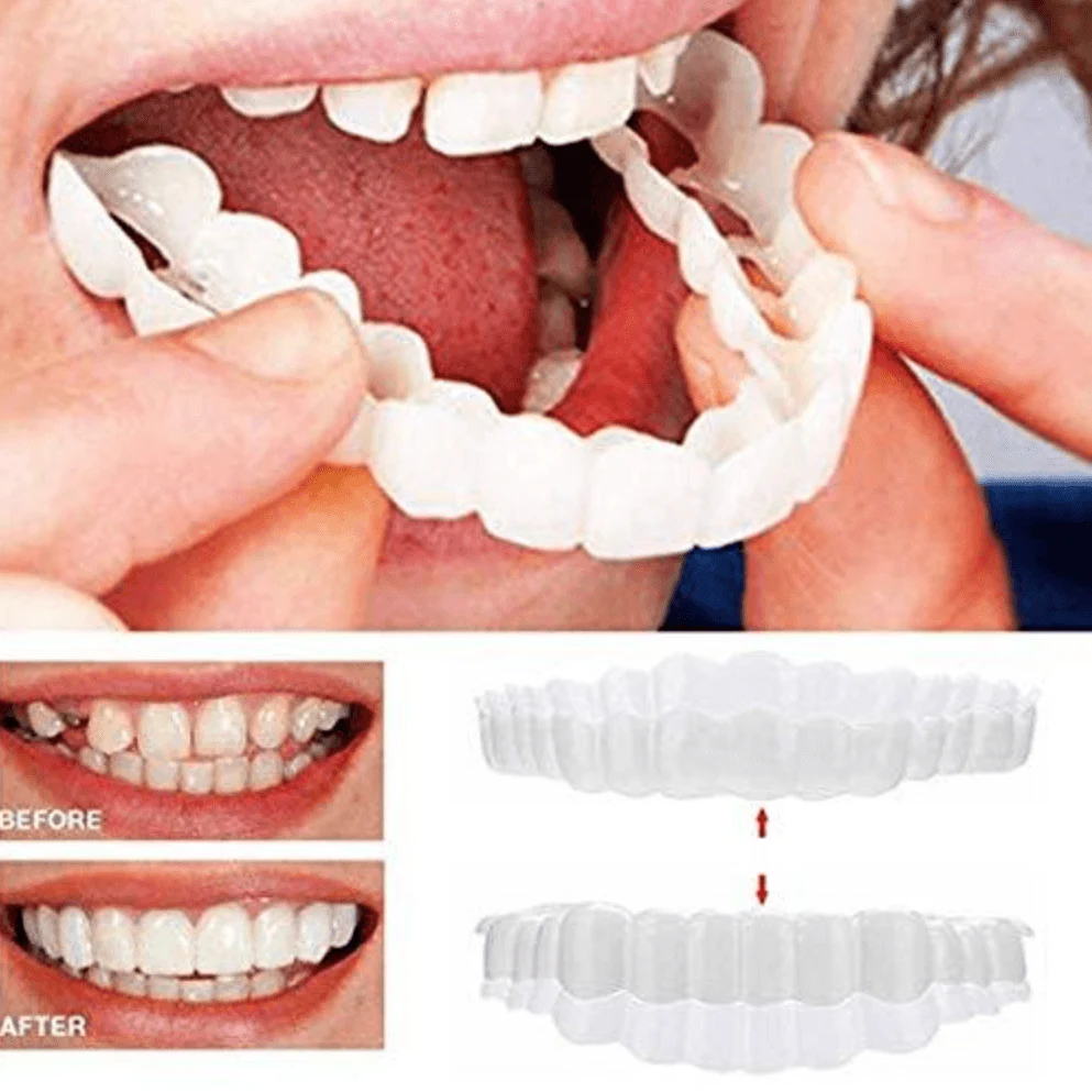 Perfect Smile Snap On Braces