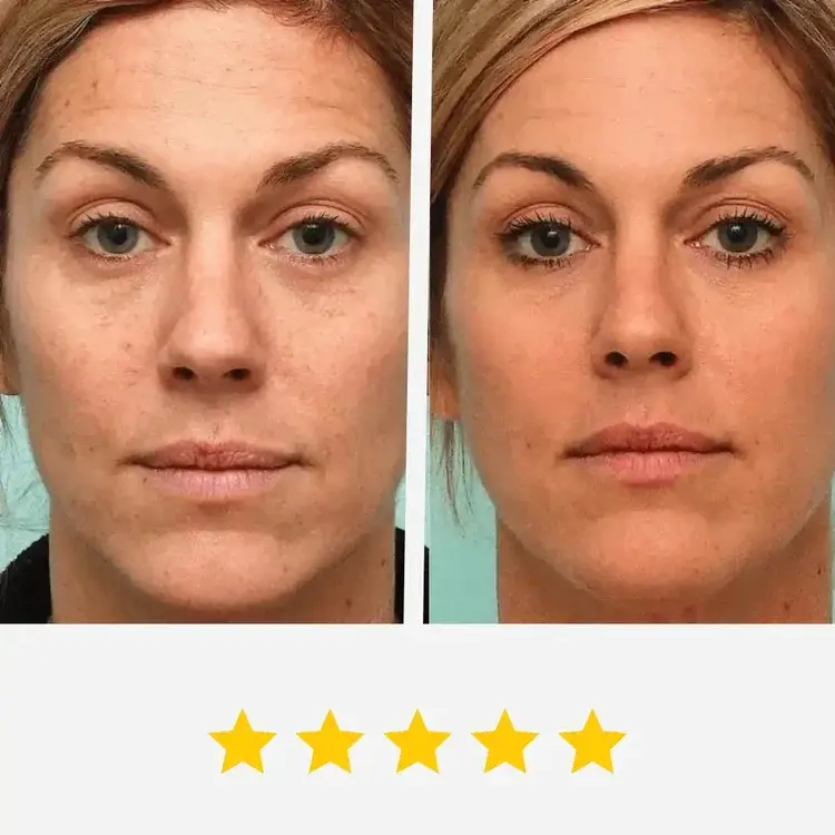 🔥LAST DAY 49% OFF🔥-For visibly firmer and radiant skin in just 2 weeks