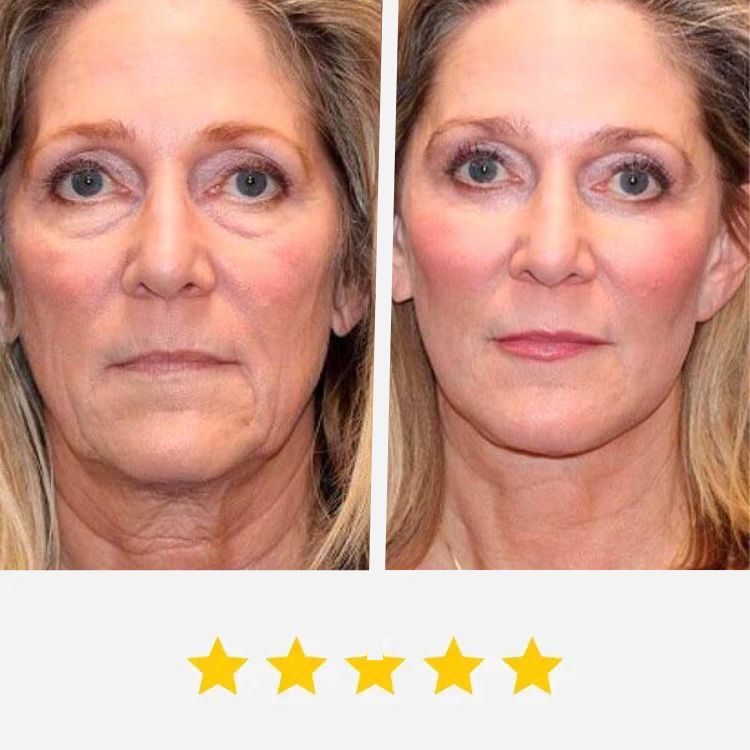 🔥LAST DAY 49% OFF🔥-For visibly firmer and radiant skin in just 2 weeks