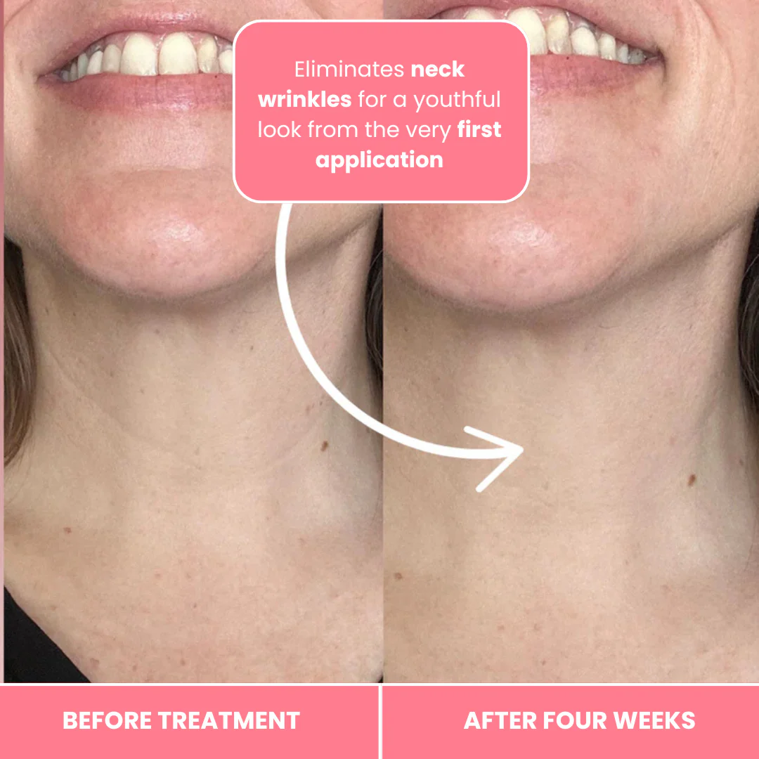 Korean Bio-Collagen Necklift Mask - Younger Neck After 1 Use