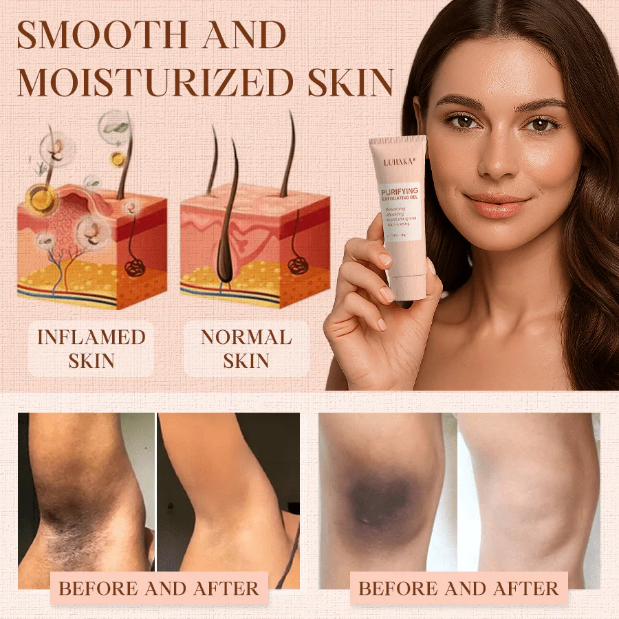 Luhaka® Purifying Exfoliating Gel for Acanthosis Nigricans, Exfoliation, Dark Spots, Skin Tags, and Eczema 🎉