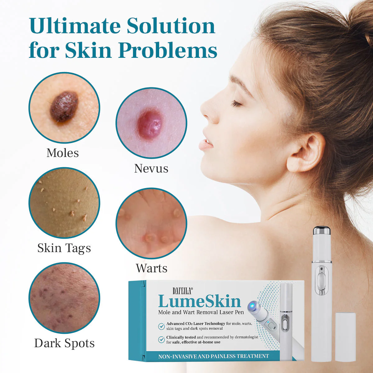 DAFEILA® LumeSkin Mole and Wart Removal Laser Pen_Ultra01