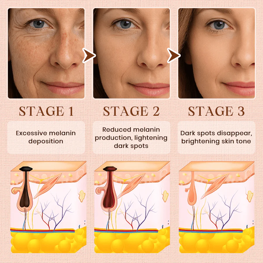 Luhaka® Purifying Exfoliating Gel for Acanthosis Nigricans, Exfoliation, Dark Spots, Skin Tags, and Eczema 🎉