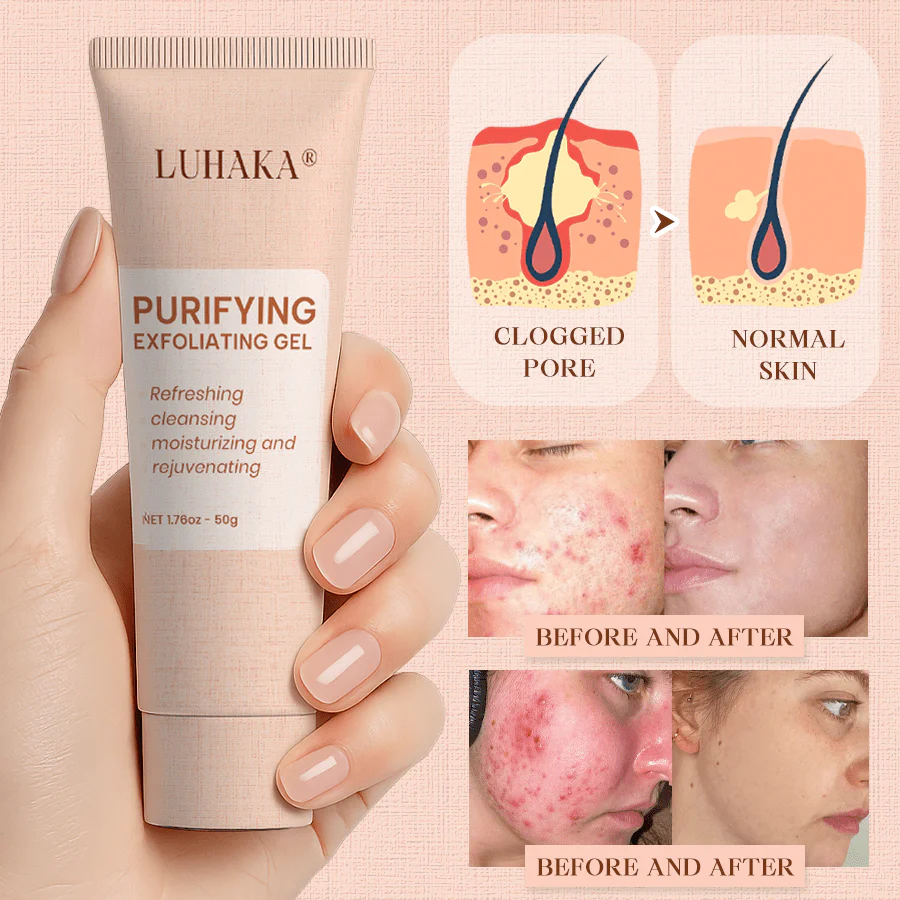 Luhaka® Purifying Exfoliating Gel for Acanthosis Nigricans, Exfoliation, Dark Spots, Skin Tags, and Eczema 🎉