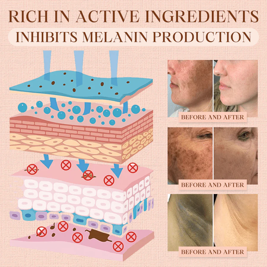 Luhaka® Purifying Exfoliating Gel for Acanthosis Nigricans, Exfoliation, Dark Spots, Skin Tags, and Eczema 🎉