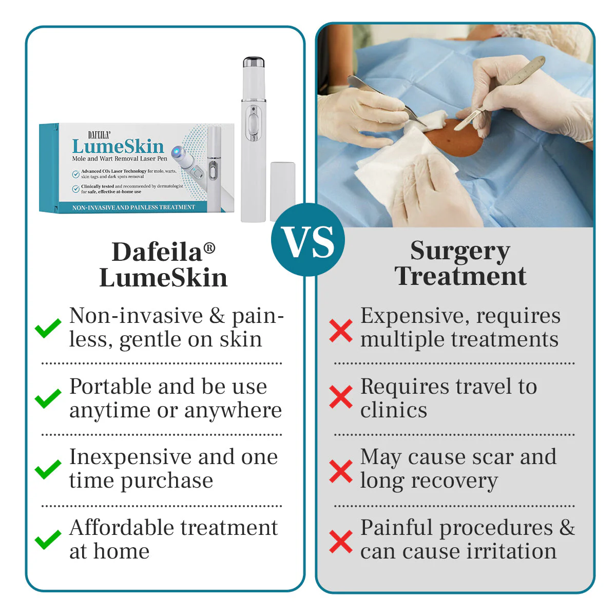 DAFEILA® LumeSkin Mole and Wart Removal Laser Pen_Ultra01
